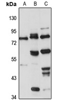 Anti-GPBP Antibody