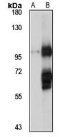 Anti-COPG2 Antibody