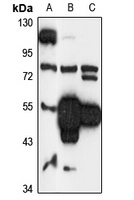 Anti-COQ6 Antibody