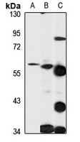 Anti-PGCP Antibody