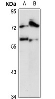 Anti-CPSF7 Antibody