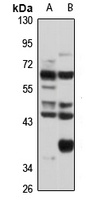 Anti-Cornulin Antibody