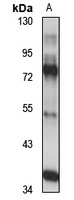 Anti-TORC3 Antibody