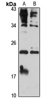 Placental Lactogen antibody