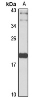 CTAG1B antibody