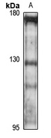 Anti-Delta-catenin Antibody