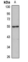 Anti-CTU2 Antibody