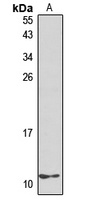 Interferon gamma antibody