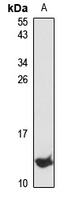 Anti-CXCL2 Antibody
