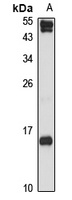 Anti-CXCL9 Antibody