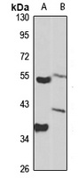 Anti-CYP11B1 Antibody