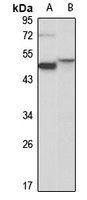 Anti-Cytochrome P450 19A1 Antibody