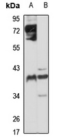 CYR61 antibody