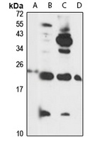 Anti-DAD1 Antibody