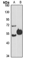 DAP Kinase 3 antibody