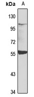 Anti-DAZ2 Antibody