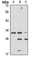 Anti-DAZL Antibody