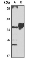 Anti-DAZL Antibody