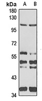 Anti-Drebrin Antibody