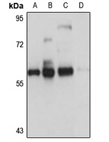 Anti-HIP-55 Antibody