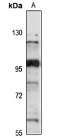 NRIP antibody