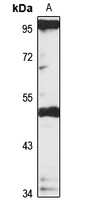 DC-STAMP antibody