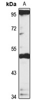 Anti-DC-STAMP Antibody