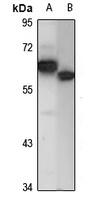 DDX56 antibody