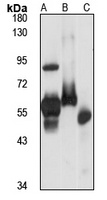 Anti-RCK Antibody