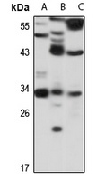 DECR2 antibody