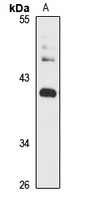 Anti-DEGS1 Antibody