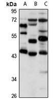 Anti-DEK Antibody