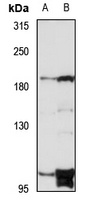 Anti-DENND4A Antibody