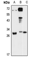 Anti-DENR Antibody