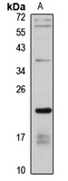 DESI2 antibody