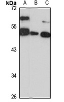 Anti-DGCR14 Antibody