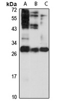 Anti-DHDDS Antibody