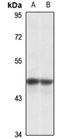 Anti-DHH Antibody