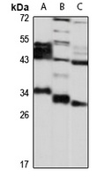 Anti-DHRS3 Antibody
