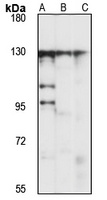 Anti-DIS3L Antibody
