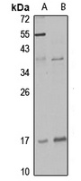 DLX6 antibody
