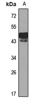 Anti-DMRT1 Antibody