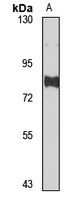 Anti-DMP1 Antibody