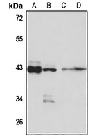 Anti-DNAJB12 Antibody