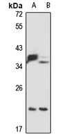 DNAJC12 antibody