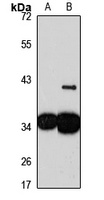 Anti-DNAJC9 Antibody