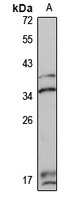 DNASE1L1 antibody