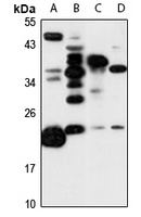 Anti-RCL Antibody