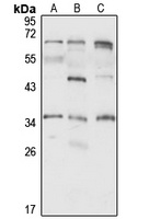 Anti-TdTIF1 Antibody