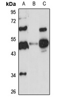 Anti-DPEP2 Antibody